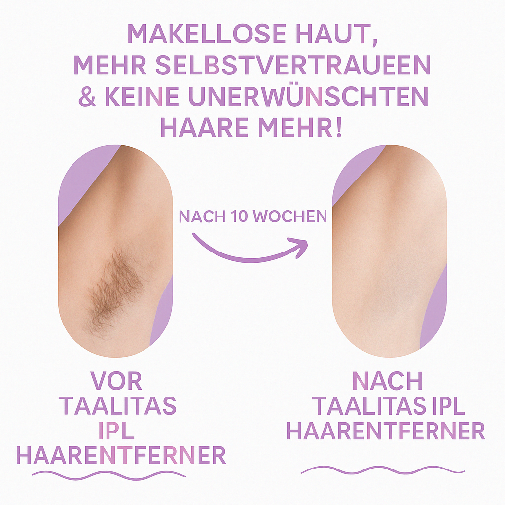 Maelita Hair Remover – Für eine glatte und haarfreie Haut in 10 Wochen